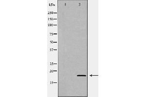 Western blot analysis of Rat spleen lysate, using LY96 Antibody.