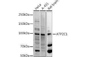 Western Blotting (WB) image for anti-ATPase, Ca++ Transporting, Type 2C, Member 1 (ATP2C1) (AA 400-660) antibody (ABIN3016170)