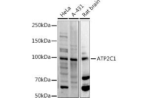 Western blot analysis of extracts of various cell lines, using C1 antibody (ABIN3016169, ABIN3016170, ABIN3016171 and ABIN6219598) at 1:500 dilution. (ATP2C1 抗体  (AA 400-660))