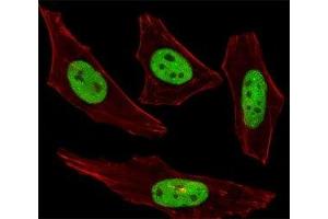 Fluorescent image of HeLa cells stained with SUMO2/3 antibody was diluted at 1:100 dilution. (SUMO2/3 抗体  (AA 49-81))
