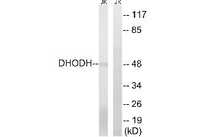 Immunohistochemistry analysis of paraffin-embedded human lung carcinoma tissue, using DHODH antibody. (DHODH 抗体  (Internal Region))