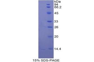 SDS-PAGE of Protein Standard from the Kit (Highly purified E. (Cathepsin D ELISA 试剂盒)