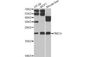 Western blot analysis of extracts of various cell lines, using PMCH antibody (ABIN2564591) at 1:1000 dilution. (PMCH 抗体)