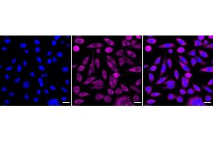 anti-Mitogen-Activated Protein Kinase Kinase Kinase 2 (MAP3K2) antibody