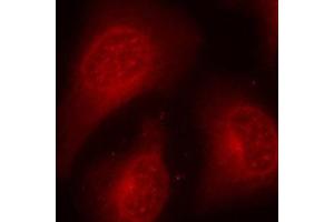 Immunofluorescence staining of methanol-fixed Hela cells using Phospho-HDAC8-S39 antibody. (HDAC8 抗体  (pSer39))
