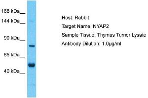Host: Rabbit Target Name: NYAP2 Sample Tissue: Human Thymus Tumor Antibody Dilution: 1ug/ml (NYAP2 抗体  (Middle Region))