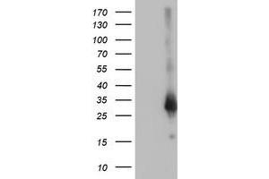 Western Blotting (WB) image for anti-Zinc Finger, AN1-Type Domain 2B (ZFAND2B) antibody (ABIN1501807)