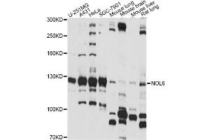 Western blot analysis of extracts of various cell lines, using NOL6 antibody (ABIN6290704) at 1:1000 dilution. (Nucleolar Protein 6 抗体)