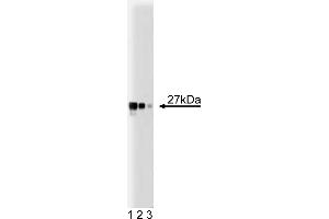 Western Blotting (WB) image for anti-Dynamin 1-Like (DNM1L) (AA 19-201) antibody (ABIN968652) (Dynamin 1-Like 抗体  (AA 19-201))