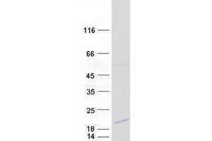 DSCR4 Protein (Myc-DYKDDDDK Tag)