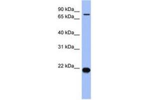 Image no. 1 for anti-Zinc Finger Protein 800 (ZNF800) (N-Term) antibody (ABIN6742935) (ZNF800 抗体  (N-Term))
