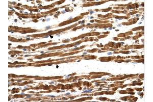 NARG1L antibody was used for immunohistochemistry at a concentration of 4-8 ug/ml. (NARG1L 抗体  (Middle Region))