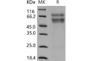 Western Blotting (WB) image for Carbohydrate (Chondroitin 6) Sulfotransferase 3 (CHST3) protein (His tag) (ABIN7320226)