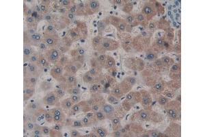 Used in DAB staining on fromalin fixed paraffin- embedded liver tissue (Dystonin 抗体  (AA 1-252))