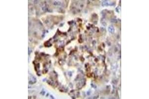 Immunohistochemistry analysis in formalin fixed and paraffin embedded human pancreas tissue reacted with GAD2 / GAD65 Antibody (Center) followed by peroxidase conjugation of the secondary antibody and DAB staining. (GAD65 抗体  (Middle Region))