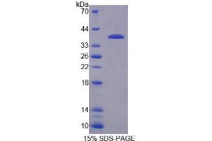 SDS-PAGE analysis of Mouse RGS9 Protein. (RGS 蛋白)