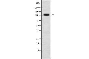 Western blot analysis of DSG3 using LOVO whole cell lysates (Desmoglein 3 抗体  (C-Term))