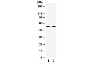 Western blot testing of human 1) HepG2 and 2) A549 cell lysate with GLUT9 antibody. (SLC2A9 抗体)