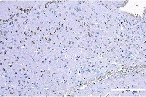 IHC analysis of RALBP1 using anti-RALBP1 antibody (ABIN7600800). (RALBP1 抗体  (AA 239-506))