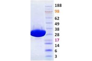 Validation with Western Blot (PAK7 Protein (Transcript Variant 2))
