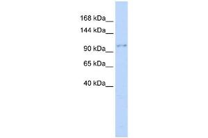 WB Suggested Anti-NEDD4 Antibody Titration:  0. (NEDD4 抗体  (Middle Region))
