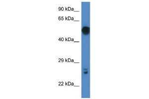 WB Suggested Anti-Gal3st4 Antibody   Titration: 1. (GAL3ST4 抗体  (C-Term))
