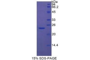 SDS-PAGE analysis of Rat Insulin Like Growth Factor Binding Protein 6 (IGFBP6) Protein. (IGFBP6 蛋白)