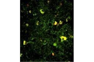 Immunofluorescence analysis of Rab5 Antibody (C-term) with paraffin-embedded human brain tissue. (RAB5 抗体  (C-Term))
