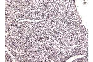 (ABIN570994) Negative Control showing staining of paraffin embedded Human Heart, with no primary antibody. (NK2 Homeobox 5 抗体  (Internal Region))