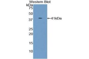 Western blot analysis of the recombinant protein. (UGT8 抗体  (AA 198-541))
