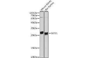 Western blot analysis of extracts of various cell lines, using GSTZ1 antibody (ABIN6132376, ABIN6141485, ABIN6141486 and ABIN6221727) at 1:500 dilution. (GSTZ1 抗体  (AA 1-216))