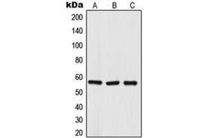 Western blot analysis of TRIM68 expression in HepG2 (A), DU145 (B), NCIH460 (C) whole cell lysates.