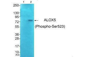 Western blot analysis of extracts from JK cells (Lane 2), using ALOX5 (Phospho-Ser523) Antibody. (ALOX5 抗体  (pSer523))