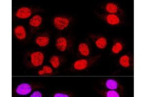 Confocal immunofluorescence analysis of U-2 OS cells using TEAD3 Polyclonal Antibody at dilution of 1:400. (TEAD3 抗体)