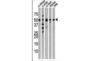 The anti-Drosophila Parkin Pab (ABIN390387 and ABIN2850546) is used in Western blot to detect Drosophila Parkin in, from left to right, mouse kidney, mouse brain, mouse heart, Ramos, and Hela tissue lysates. (Parkin 抗体  (N-Term))