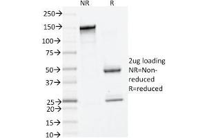 SDS-PAGE Analysis Purified Tryptase Mouse Monoclonal Antibody (TPSAB1/1961). (TPSAB1 抗体  (AA 115-233))