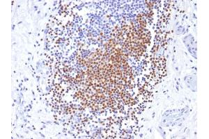Immunohistochemistry (IHC) image for anti-Paired Box 8 (PAX8) (AA 60-261) antibody (ABIN6940924)