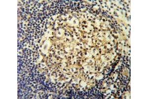 CCR7 antibody IHC analysis in formalin fixed and paraffin embedded human tonsil. (CCR7 抗体  (AA 11-37))