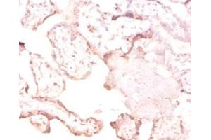 Immunohistochemistry of paraffin-embedded human placenta tissue using ABIN7166803 at dilution of 1:50 (FTSJ1 抗体  (AA 1-329))