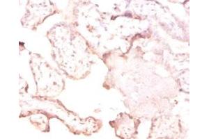 Immunohistochemistry of paraffin-embedded human placenta tissue using ABIN7166803 at dilution of 1:50 (FTSJ1 抗体  (AA 1-329))