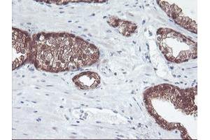 Image no. 3 for anti-Aminoacylase 1 (ACY1) antibody (ABIN1496455)