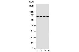 Western blot testing of NRG2 antibody and Lane 1:  rat liver (Neuregulin 2 抗体  (Middle Region))