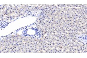 Detection of GKRP in Rat Liver Tissue using Polyclonal Antibody to Glucokinase Regulatory Protein (GKRP)