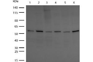 All lanes : CBX2 Rabbit mAb at 1/1k dilution Lane 1 : Hela whole cell lysates Lane 2 : SH-SY5Y whole cell lysates Lane 3 : MCF7 whole cell lysates Lane 4 : 3T3 whole cell lysates Lane 5 : C6 whole cell lysates Lane 6 : Rat Brain lysates Lysates/proteins at 20 μg per lane. (Recombinant CBX2 抗体)