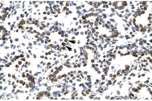 Human Lung; ZNF385 antibody - N-terminal region in Human Lung cells using Immunohistochemistry (ZNF385A 抗体  (N-Term))