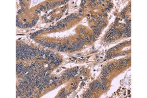 Immunohistochemistry (IHC) image for anti-S100 Calcium Binding Protein A13 (S100A13) antibody (ABIN2428683) (S100A13 抗体)