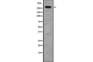 Western blot analysis of DSP using HuvEc whole cell lysates (Desmoplakin 抗体  (C-Term))