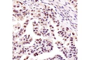 Immunohistochemistry (Paraffin-embedded Sections) (IHC (p)) image for anti-Zinc Finger Protein 307 (ZKSCAN4) antibody (ABIN7076265)