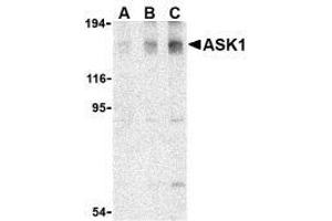 Western blot analysis of ASK1 in SW1353 cell lysate with AP30086PU-N ASK1 antibody at (A) 0. (ASK1 抗体)