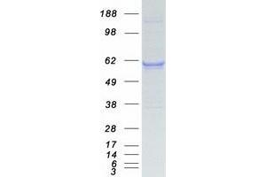 Western Blotting (WB) image for Karyopherin alpha 2 (RAG Cohort 1, Importin alpha 1) (KPNA2) protein (Myc-DYKDDDDK Tag) (ABIN2724403)